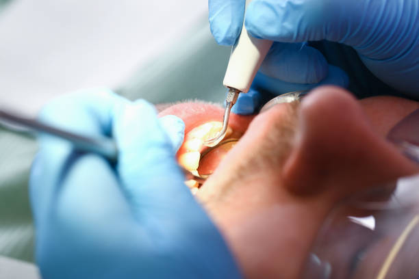 Best Cracked Tooth Emergency Dentist  in Alamo Heights, TX